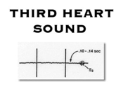 Third Heart Sound