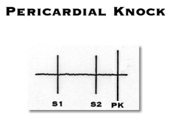 Pericardial Knock