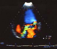 Photo of doppler ultrasound or echo.