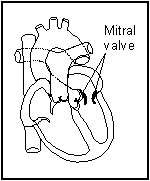 Diagram showing the mtral valve controls blood flow from the left atrium into the left venticle.