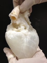 A &quot;ghost heart&quot;