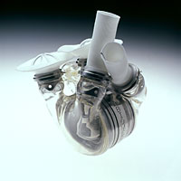 The AbioCor implantable replacement heart