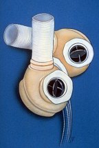 The Jarvik-7 total artificial heart